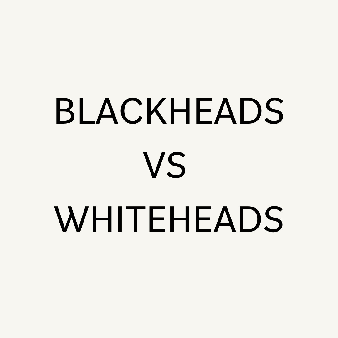 Blackheads vs Whiteheads. Why do I get them and how do I get rid of them? - PORE FAVOR USA