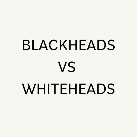 Blackheads vs Whiteheads. Why do I get them and how do I get rid of them? - PORE FAVOR USA