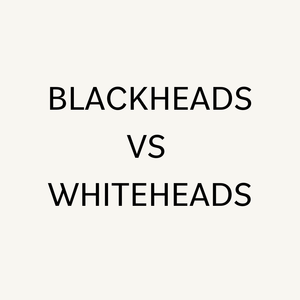 Blackheads vs Whiteheads. Why do I get them and how do I get rid of them?
