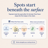 Acne Supplement