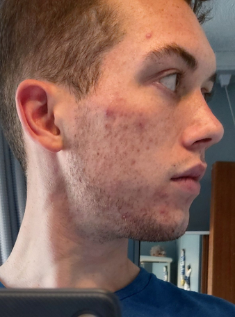 Before image